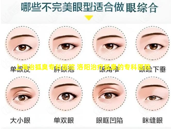 上海治狐臭专科医院 洛阳治疗狐臭的专科医院